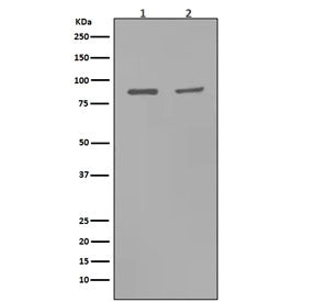 Western blot testing with MMP9 antibody. Expected molecular weight: ~92 kDa (precursor), 67-80 kDa (