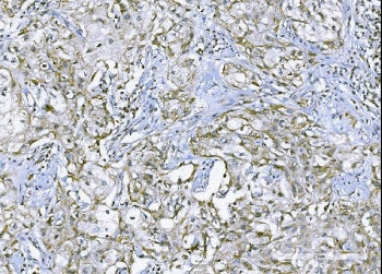 TNF alpha Antibody