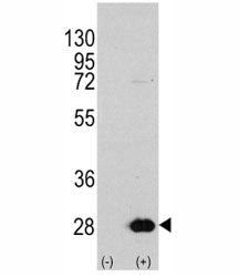 Western blot analysis of HSPB1 antibody and 293 cell lysate either nontransfected (Lane 1) or transi