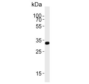 Western blot testing of human Jurkat cell lysate with TYSY antibody. Predicted molecular weight ~36 