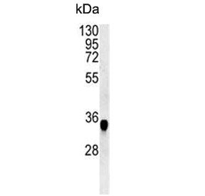 Western blot testing of mouse spleen tissue lysate with CYRIA antibody. Predicted molecular weight ~