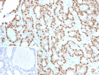 IHC staining of FFPE human thyroid tissue with Cyclin D1 antibody (clone CCND1/12039). Inset: PBS us