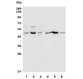 Western blot testing of human 1) A549, 2) PC-3, 3) U-2 OS, 4) rat kidney, 5) rat spleen and 6) mouse