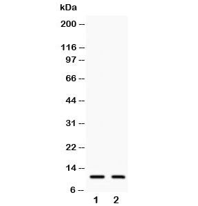 Western blot testing of human 1) COLO320 and 2) A549 lysate with Eotaxin antibody Predicted molecula