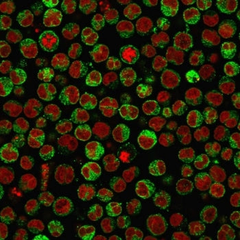 Immunofluorescent staining of PFA-fixed human Raji cells with CD79 antibody (clone SPM550, green) an