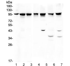 Western blot testing of 1) rat brain, 2) rat testis, 3) rat liver, 4) mouse liver, 5) mouse spleen, 6) mouse NIH3T3 and 7) human HeLa lysate with ALIX antibody. Expected/observed molecular weight ~96 kDa.