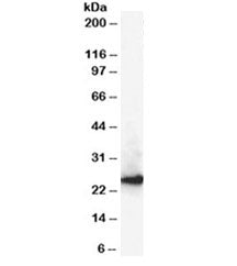 CBX1 Antibody