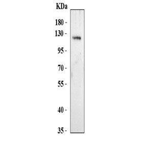 Western blot testing of human 293T cell lysate with NALP9 antibody. Predicted molecular weight ~113 