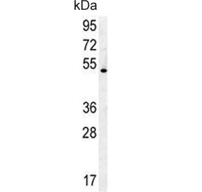 Western blot testing of human NCI-H460 cell lysate with DENND1B antibody. Predicted molecular weight