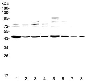PDK2 Antibody / Pyruvate dehydrogenase kinase 2
