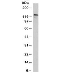 P-Cadherin Antibody / CDH3