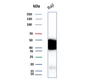 Western blot testing of human Raji cell lysate with recombinant CD48 antibody. Expected molecular we