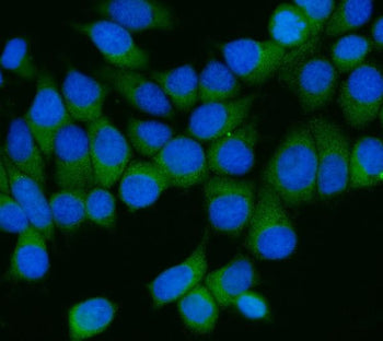 Immunofluorescent staining of FFPE human MCF7 cells with AP2M1 antibody (green) and DAPI nuclear sta