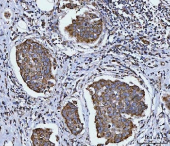 SIRT5 Antibody