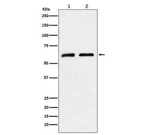 Western blot testing of 1) human A673 and 2) mouse brain tissue lysate with Caseinolytic protease X 