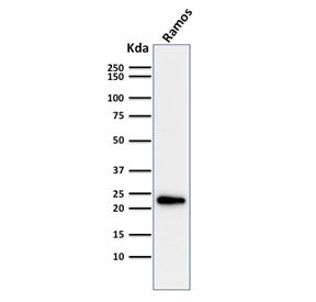 Western blot testing of human Ramos cell lysate with LMO2 antibody. Predicted molecular weight ~25 k