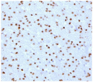 IHC testing of FFPE human cerebellum with OLIG2 antibody (clone ODTF2-1). HIER: boil tissue sections