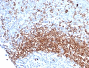 IHC staining of FFPE human tonsil tissue with recombinant IgD antibody (clone IGHD/6818R). Inset: PB