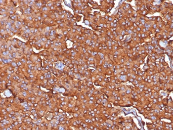 IHC staining of FFPE human adrenal tissue with Synaptophysin antibody (clone SYP/7976R). HIER: boil 