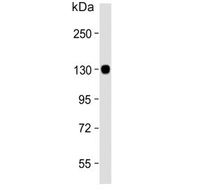 Western blot testing of human brain lysate with Autotaxin antibody. Expected molecular weight: 99-12