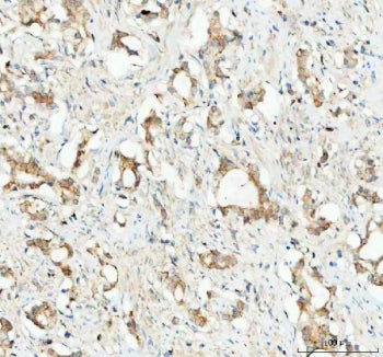 GPX1 Antibody / Glutathione Peroxidase 1