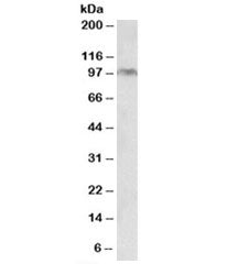 Western blot testing of HeLa lysate with Aryl Hydrocarbon Receptor antibody at 0.2ug/ml. Predicted m