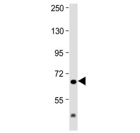 Western blot testing of mouse brain lysate with IL1RAP antibody at 1:2000. Predicted molecular weigh