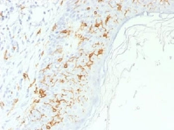 IHC testing of FFPE human skin with CD1a antibody. Required HIER: boil tissue sections in 10mM citra