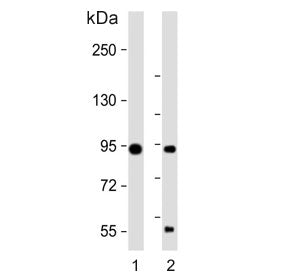 Western blot testing of 1) mouse cerebellum and 2) rat cerebellum tissue lysate with TRPV1 antibody.