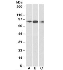 Western blot testing of human frontal cortex [A], mouse [B] and rat [C] brain lysate with ELMO1 anti