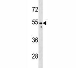 PAX2 Antibody