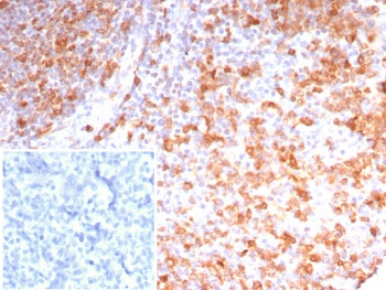 STMN1 Antibody / Stathmin 1