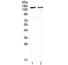 Western blot testing of 1) rat heart and 2) mouse heart lysate with MYBPC3 antibody at 0.5ug/ml. Pre