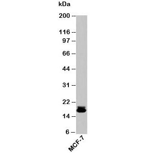 Western blot testing of human samples with Survivin antibody at 2ug/ml. Predicted molecular weight ~