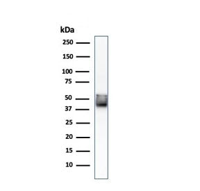 KRT8 Antibody / Cytokeratin 8