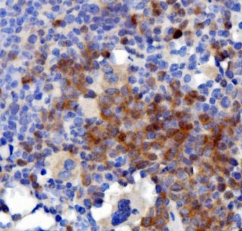 IL3 Antibody