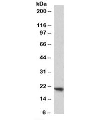 Western blot testing of human placenta lysate with FTH1 antibody at 1ug/ml. Predicted molecular weig