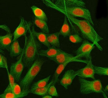 Immunofluorescent staining of FFPE human HeLa cells with PSIP1 antibody (red) and Beta Tubulin mAb (