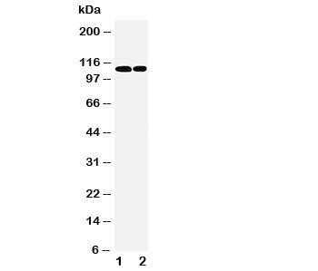 Western blot testing of p107 antibody and Lane 1: 239T; 2: Jurkat cell lysate