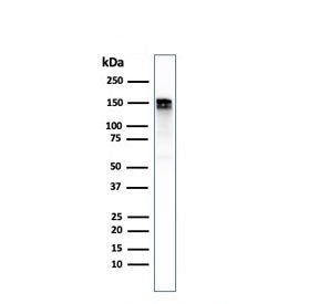 Western blot testing of human A431 cell lysate with recombinant EGF Receptor antibody. Expected mole