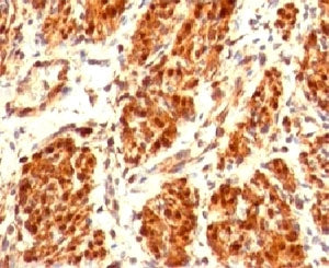 IHC testing of FFPE human uterus and Calponin antibody (clone CLPN5-1). Staining of formalin-fixed t