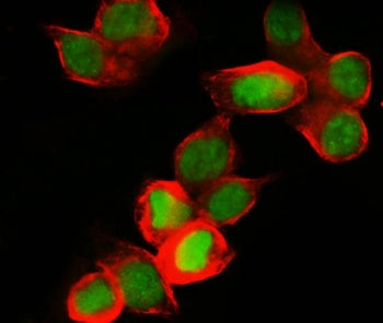 Immunofluorescent staining of FFPE human MCF7 cells with MCM7 antibody (green) and Alpha Tubulin mAb