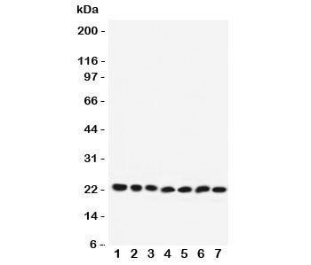 RAB9A Antibody
