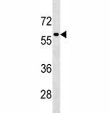 TFEB antibody western blot analysis in HepG2 lysate. Expected molecular weight: 53-60 kDa (unmodifie