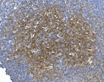 IHC staining of FFPE human tonsil with GCHFR antibody. HIER: boil tissue sections in pH8 EDTA for 20