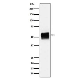 Western blot analysis of Phospho-Tau (S202) expression in mouse hippocampus cell lysate using Phosph