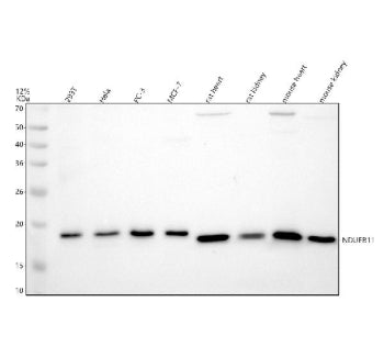 Western blot analysis of NDUFB11 using anti-NDUFB11 antibody. Electrophoresis was performed on a 12%
