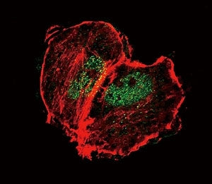 Confocal immunofluorescent analysis of phospho-Tuberin antibody with MCF-7 cells followed by Alexa F
