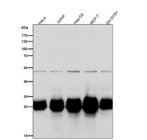 Western blot testing of human samples using the BCL2L1 antibody at 1:1000 dilution for 1 hour at roo