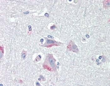 IHC testing of FFPE human cortex (brain) tissue with CRF1 antibody at 5ug/ml. Required HIER: steamed